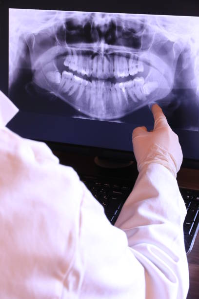 Best Urgent Care for Lost Fillings or Crowns in Moncks Corner, SC